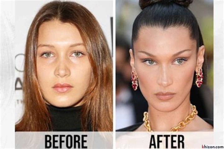 Aryna Sabalenka | Plastic Surgery Before And After