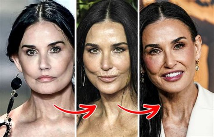 Demi Moore Plastic Surgery Update,What Has She Done To her Face?