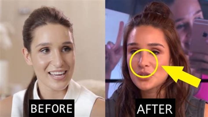 
Did Kayla Itsines Get A Nose Job? Before & After Pictures of The Fitness Instructor 