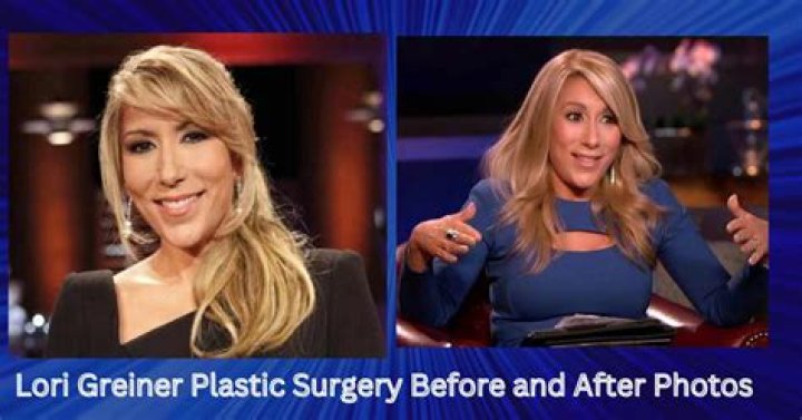 Did Lori Greiner Undergo Plastic Surgery? Before And After Photos Of The Shark Tank Star