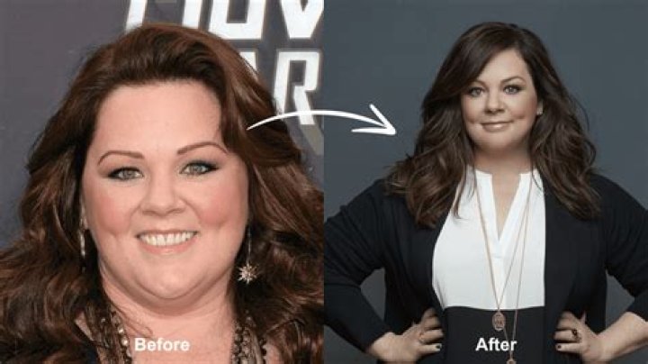 Did Melissa Grelo Undergo Plastic Surgery To Look Thin Or Does She Have An Illness? Weight Loss Explained