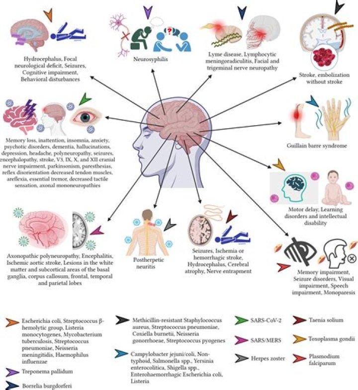 Does Liza Minelli Have Dementia? Health Condition & Encephalitis, What Is Wrong With Her?