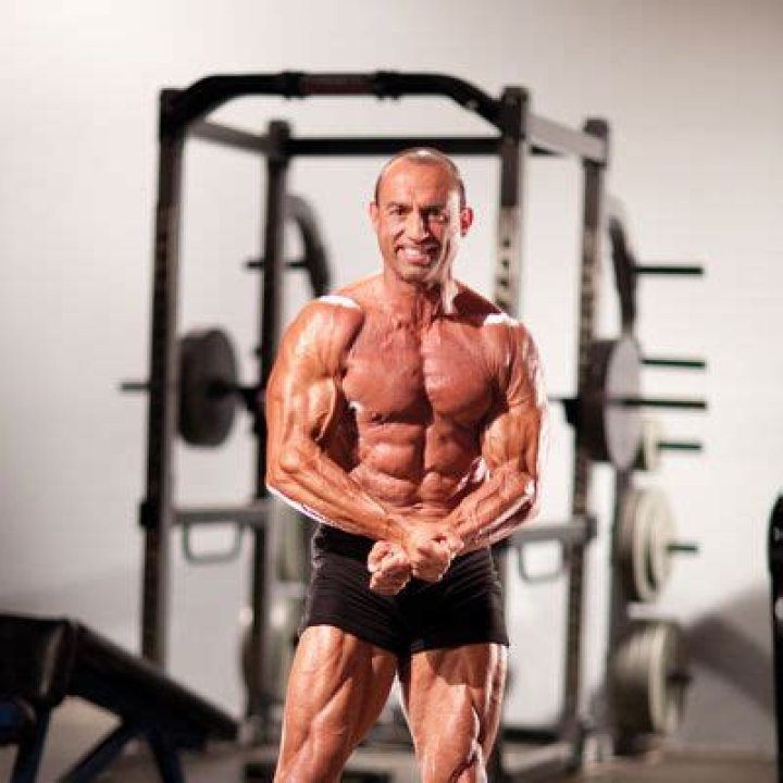 
Doug Brignole Passed Away At The Age Of 62 