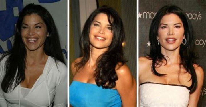 
Lauren Sanchez Before Surgery – Did She Underwent Plastic Surgery? 