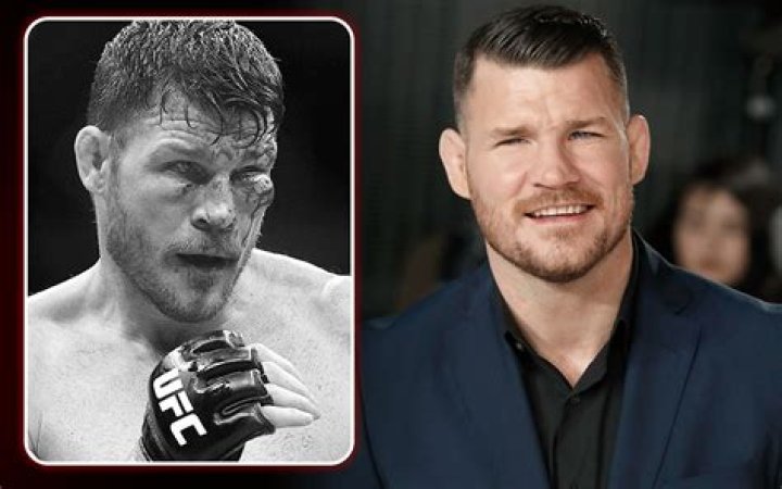 
Michael Bisping Eye Injury – Does He Wear An Eye Glass? Actor’s Injury Explained 