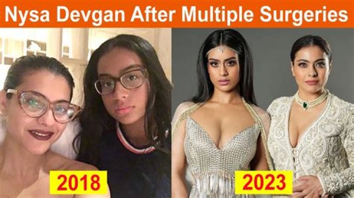 Nysa Devgan Before And After: Everything About Her Transformation