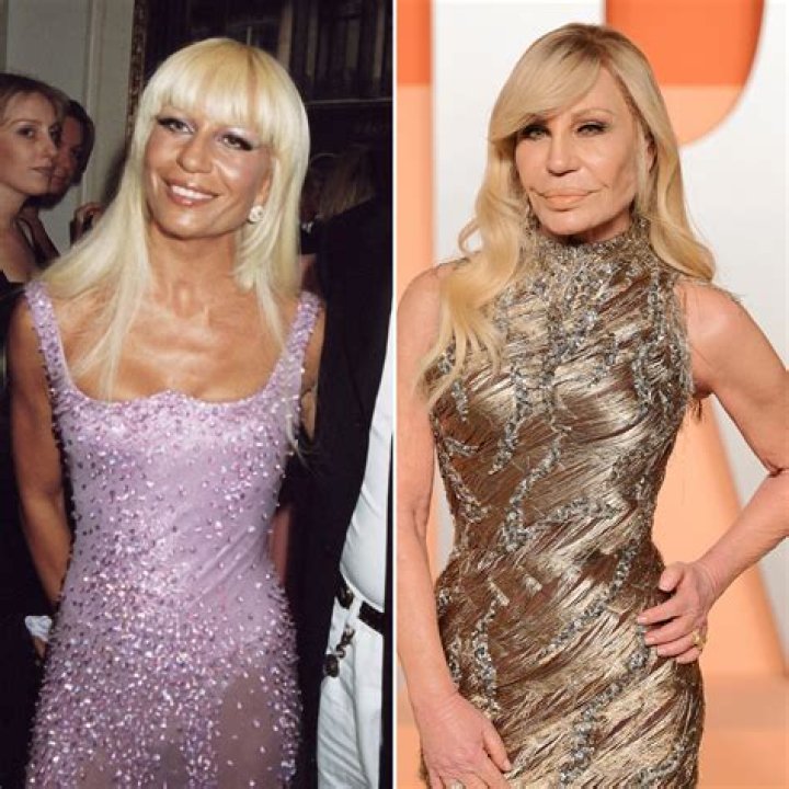 Photos Of Donatella Versace Face Before Plastic Surgery: Grammys 2022 Red-Carpet Look Wows Fans