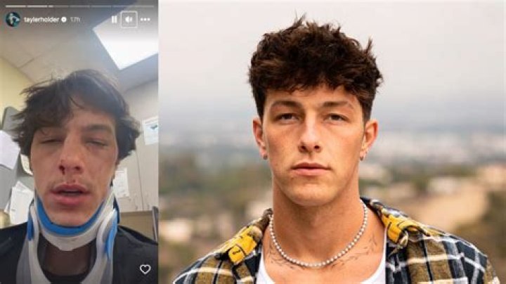 
Tayler Holder Accident Details: What Happened To Him? Health Update And Age 