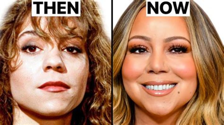 What Is Wrong With Carly Simon Face | Plastic Surgery Before And After